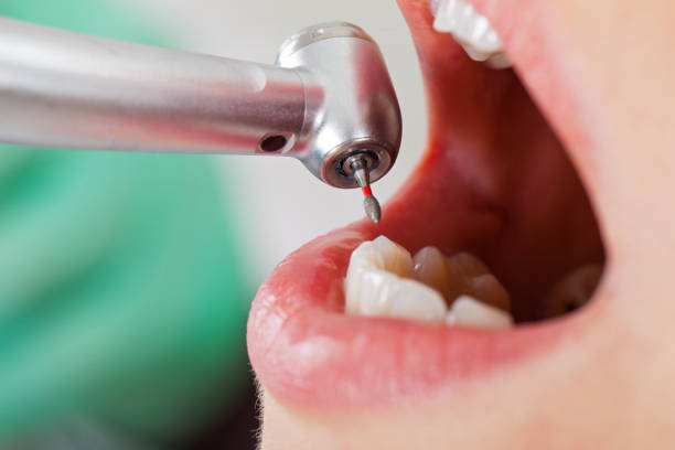Best Emergency Dentist for Knocked-Out Tooth in Osceola Mills, PA